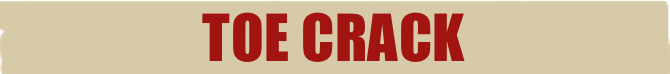 toe crack